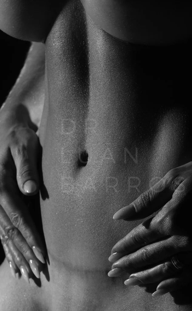 Abdominoplastia com o Dr. Luan Barros